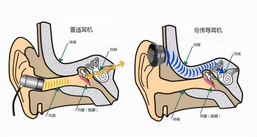 骨传导耳机的工作原理是什么？骨传导耳机为什么会漏音？